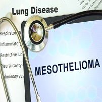 Wilmington mesothelioma lawyers report on the new glowing tumor technology to assist with surgery.