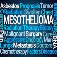 Georgetown mesothelioma lawyers assist asbestos exposure victims.