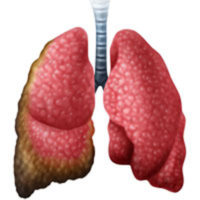 Delaware mesothelioma lawyers handle complex asbestos litigation cases.